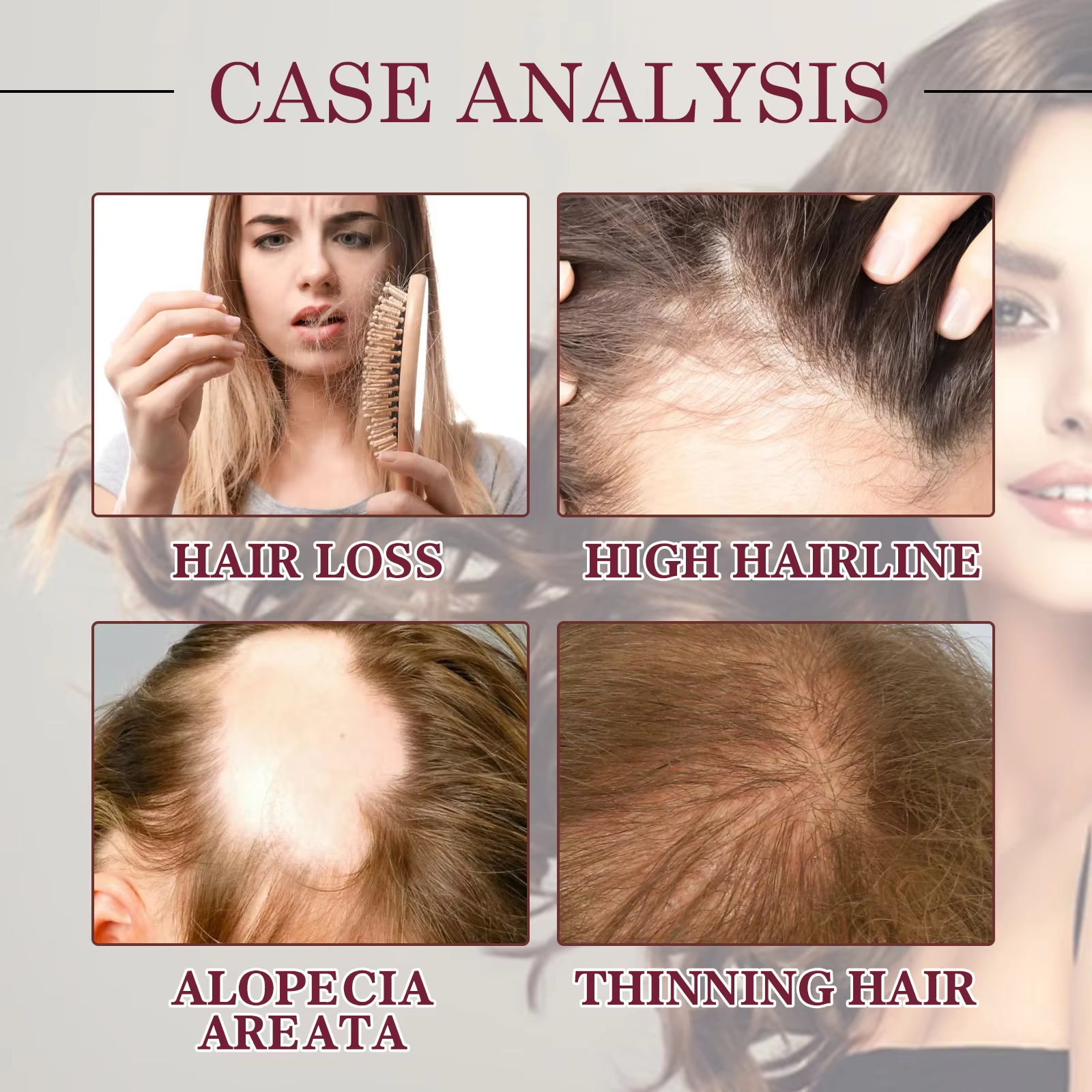 Natural Organic Scalp Vegan Red Onion Extract Hair Regrowth Essential Oil Damaged Hair  Loss Treatment Hair Care Oil