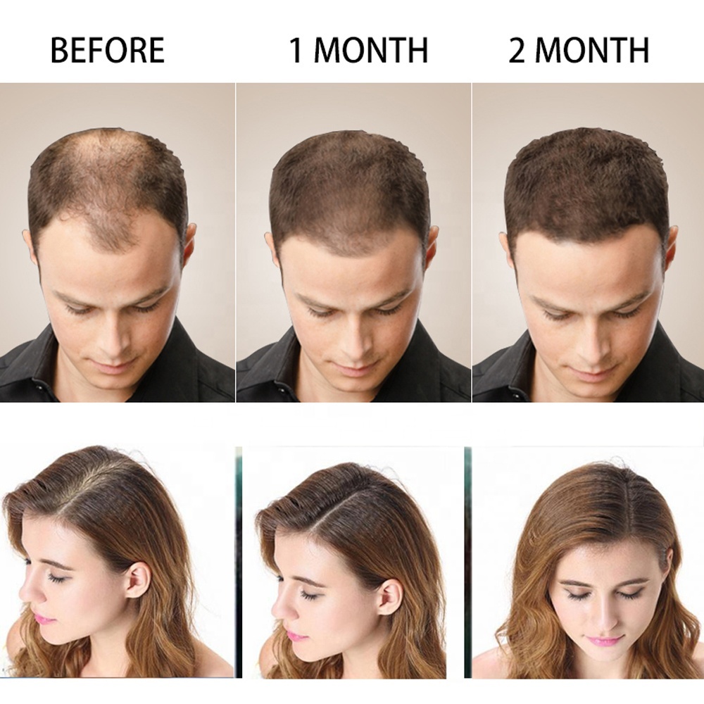 Disaar Anti Hair Loss Shampoo Organizer Men and Women Natural Ginger Growth Hair Shampoo for Damage Hair
