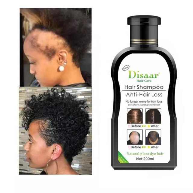 Disaar Anti Hair Loss Shampoo Organizer Men and Women Natural Ginger Growth Hair Shampoo for Damage Hair