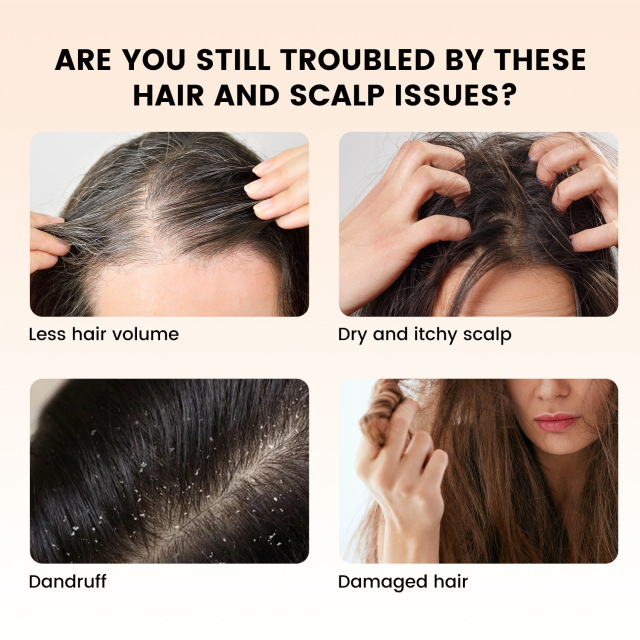 OEM/OBM 120ml Herbal Hair Care Oil Organic Rosemary Fenugreek Keratin Nourishing Moisturizing for hair care