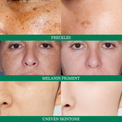 OEM Beauty Moisturizing Brightening Smooth Whitening Face Cream Day and Night MOOYAM Dark Spots Corrector Cream