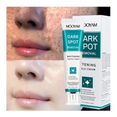 7 Days Dark Spots Anti Freckle Whitening Cream Strong Powerful  Dark Spot Removal Cream