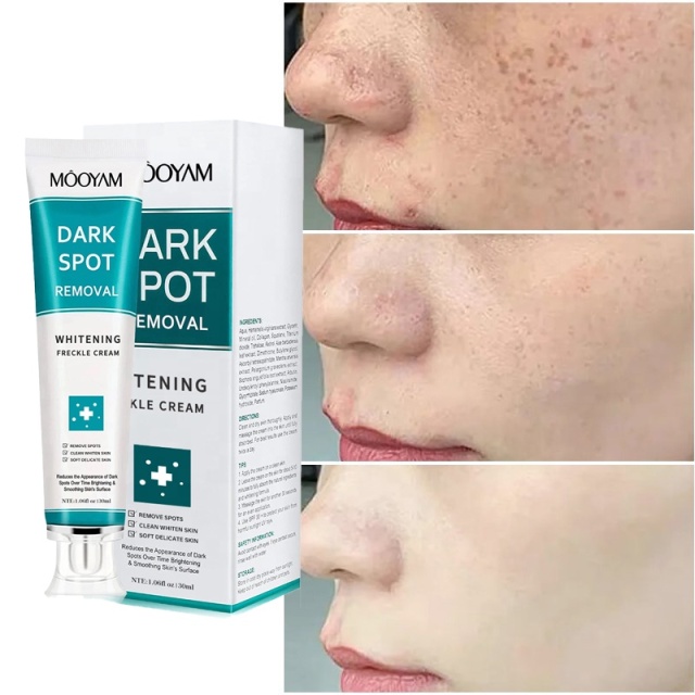 7 Days Dark Spots Anti Freckle Whitening Cream Strong Powerful  Dark Spot Removal Cream