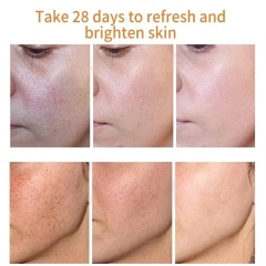 7 Days Dark Spots Anti Freckle Whitening Cream Strong Powerful  Dark Spot Removal Cream