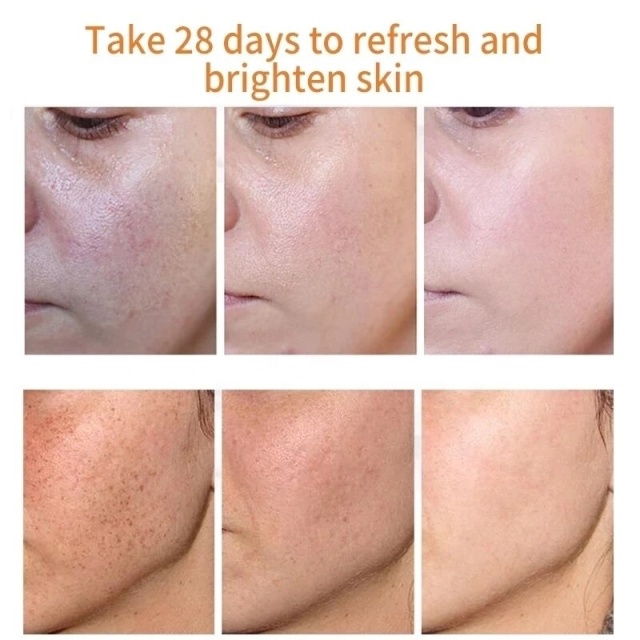 7 Days Dark Spots Anti Freckle Whitening Cream Strong Powerful  Dark Spot Removal Cream