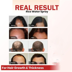 Private Label 60ml Herbal Hair Growth Oil Spray Anti-Loss Hair Serum for Thicken and Refreshing Hair-Loss Prevention Feature