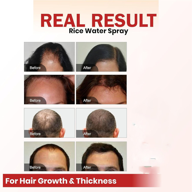 Private Label 60ml Herbal Hair Growth Oil Spray Anti-Loss Hair Serum for Thicken and Refreshing Hair-Loss Prevention Feature