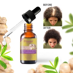 Natural Pure Hair Growth Essential Oil Ginger Hair Growth Oil 30ml