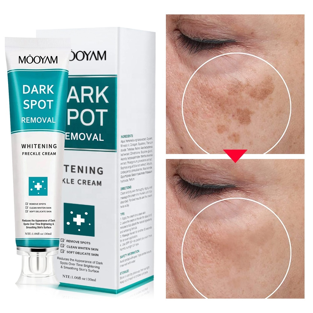 7 Days Dark Spots Anti Freckle Whitening Cream Strong Powerful  Dark Spot Removal Cream