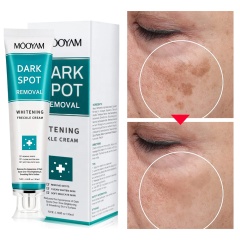 7 Days Dark Spots Anti Freckle Whitening Cream Strong Powerful  Dark Spot Removal Cream