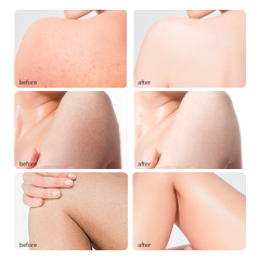 OEM ODM 100% Pure Jamaican Black Castor Oil Cold Pressed Organic Hair Scalp Care Skin Care Hair Growth Eyelash Growth Castor Oil