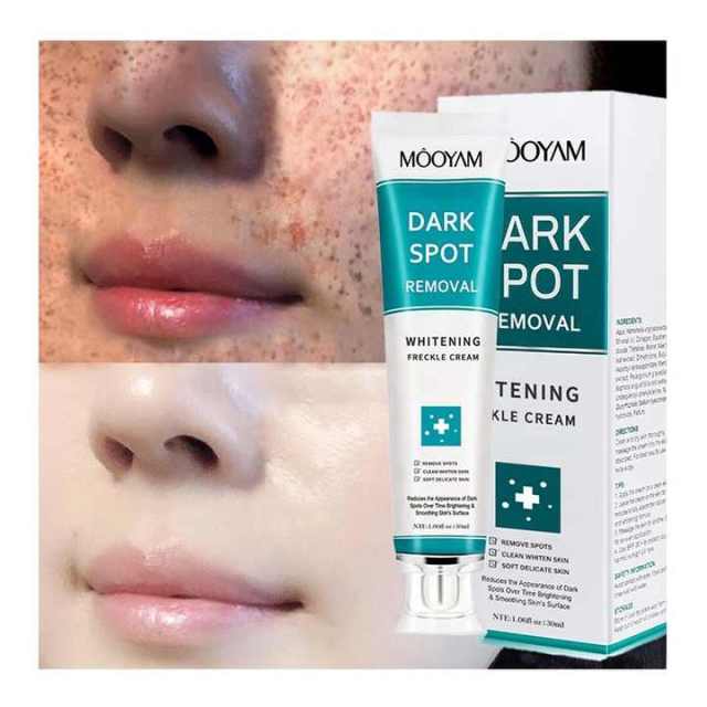 7 Days Dark Spots Anti Freckle Whitening Cream Strong Powerful  Dark Spot Removal Cream