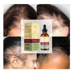 Private Label Organic Rosemary Peppermint Hair Growth Oil Natural Scalp Care Massage Hair Oil Smoothing Herbal Hair Regrowth