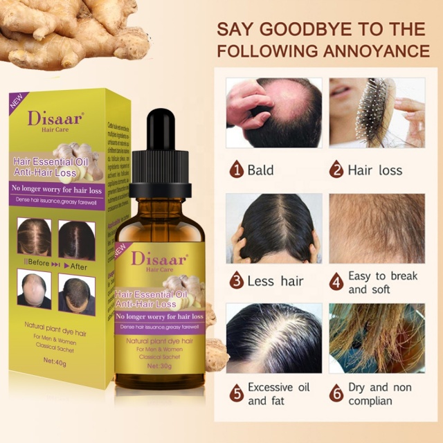 Natural Pure Hair Growth Essential Oil Ginger Hair Growth Oil 30ml