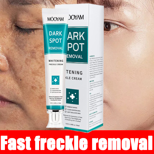 7 Days Dark Spots Anti Freckle Whitening Cream Strong Powerful  Dark Spot Removal Cream
