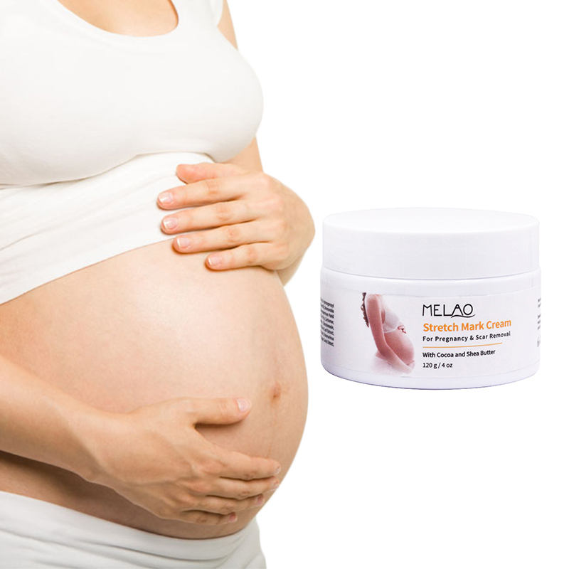 Pregnancy Stretch Marks Removal Cream Cellulite Massage Organic Scar Removal Gel Stretch Marks Cream With Cocoa and Shea Butter