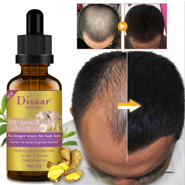 Natural Pure Hair Growth Essential Oil Ginger Hair Growth Oil 30ml
