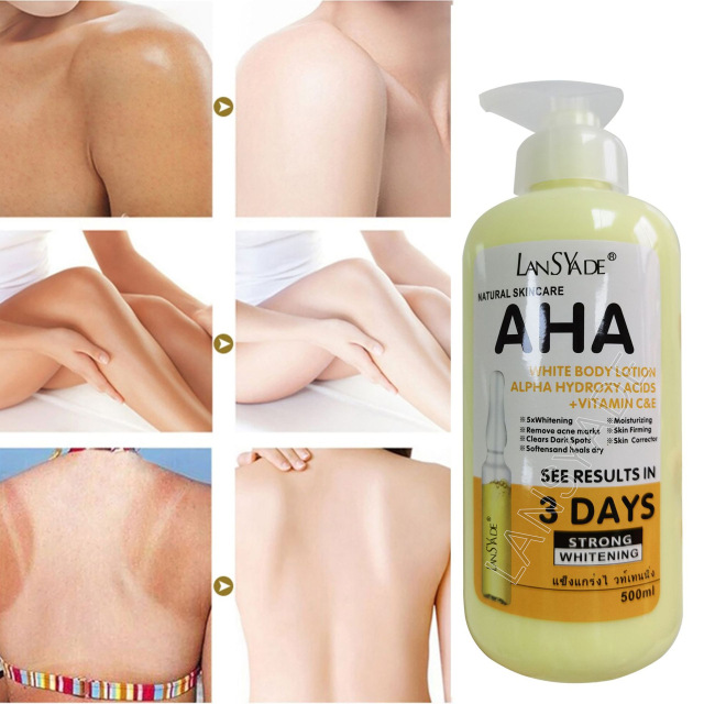 Niacinamide Whitening Lotion and Body Cream for Female Rapid Skin Bleaching and Instant Whitening for Face and Body