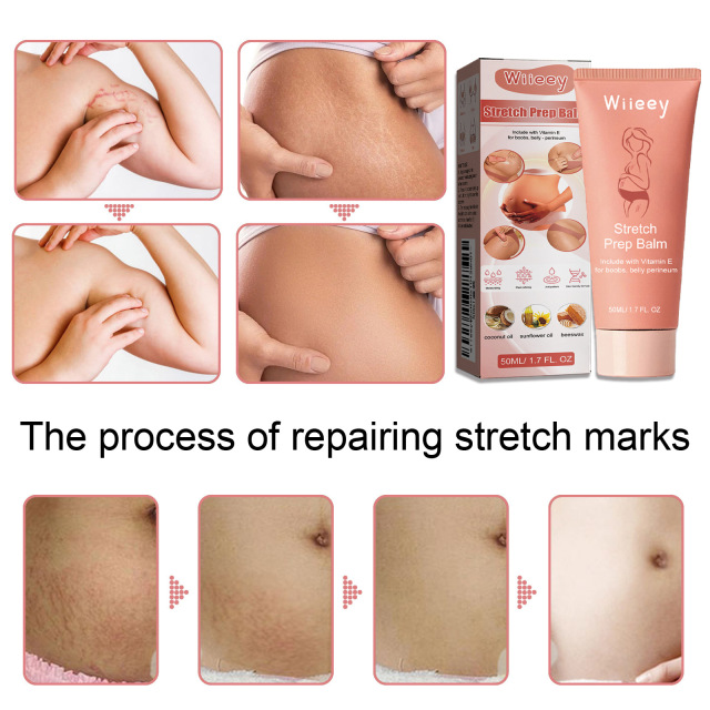 Hot Sale Vegan Stretch Marks Removal Cream Postpartum Body Care Repair Firming Stretch Marks Cream