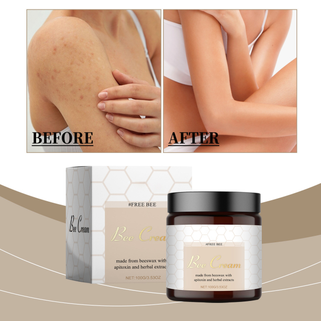 Private Label Natural Skin Care Improves Dry Skin Moisturizes Body Face Scar Cream Bee Venom Cream