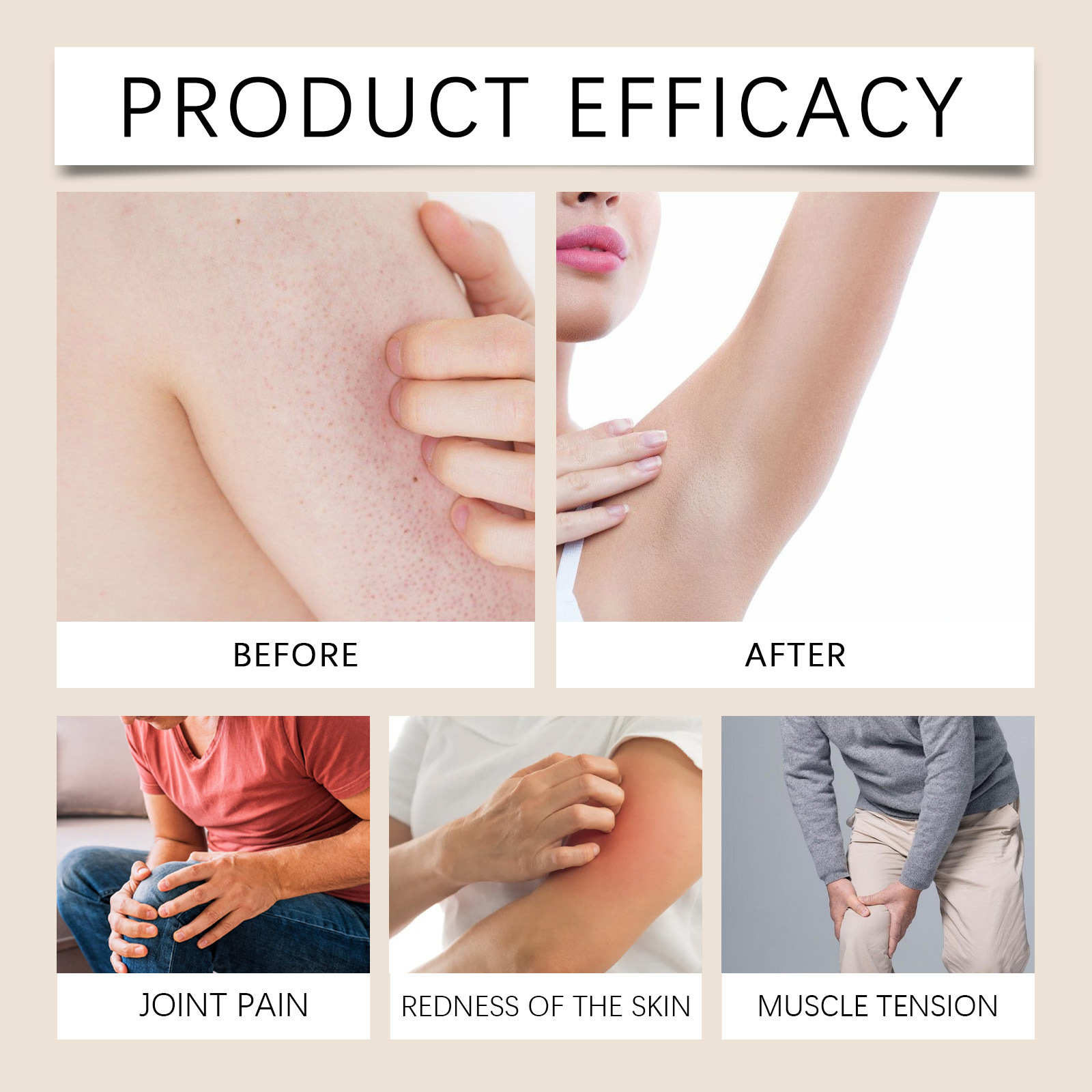 Private Label Natural Skin Care Improves Dry Skin Moisturizes Body Face Scar Cream Bee Venom Cream