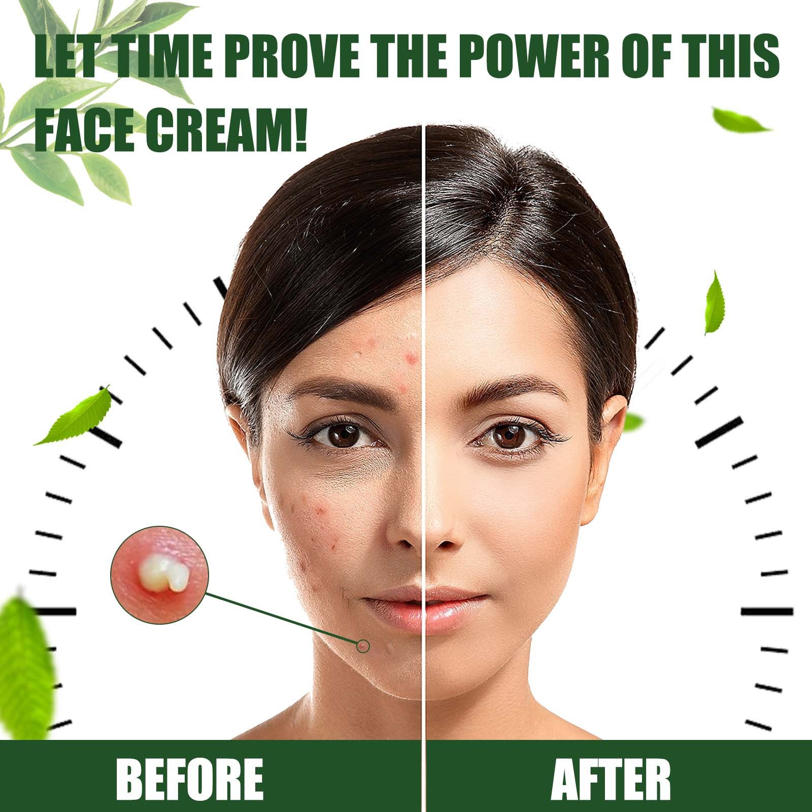 Pearl Beauty Nourishing and Whitening Cream Day Adults Female Skin Lightening Cream Face Moisturizer Cream Golden 3 Years 100g