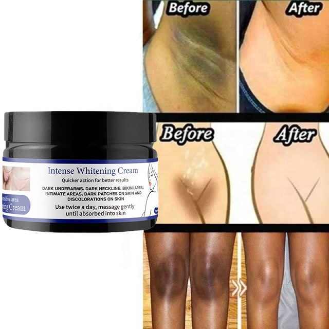 Dark Inner Thighs Cream Bikini Area Brightening Intense Whitening Cream for Dark Knees Knuckles Elbows Armpit Private Part