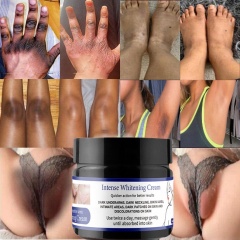 Dark Inner Thighs Cream Bikini Area Brightening Intense Whitening Cream for Dark Knees Knuckles Elbows Armpit Private Part
