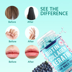 OEM Private Label High Content Biotin Vitamins Halal Gummy Bears Vitamins Pectin Gummy Support Hair Growth Skin Nails Healthy