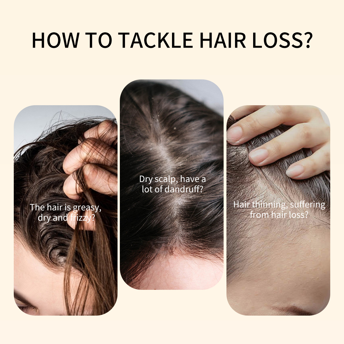 Private Label Natural Organic Red Onion Hair Oil Anti Hair Loss Repair Scalp Rosemary Bio Onion Oil for Hair Growth