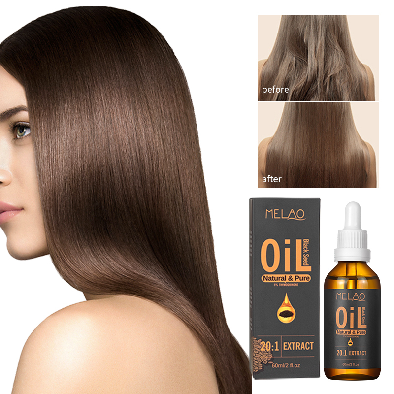Natural Thymoquinone Body Repair Damage Skin Care Black Cumin Seed Oil Dry and Frizzy Hair Essential Oil Black Seed Oil