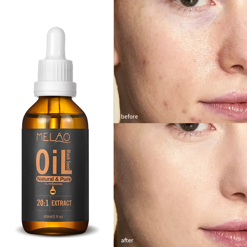 Natural Thymoquinone Body Repair Damage Skin Care Black Cumin Seed Oil Dry and Frizzy Hair Essential Oil Black Seed Oil