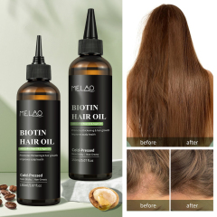 Private Label Essential Hair Loss Oil Growth Oil Hair Strengthening Dandruff Itchy Deep Biotin Hair Oil