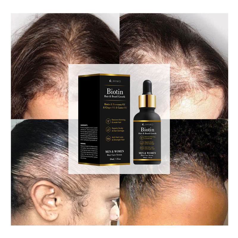 Customizable Hair Growth Essential Oil with Organic Peppermint Ginger Herbal Ingredients Vegan Nourishing and Logo Added