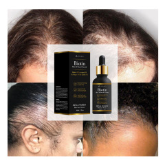 Customizable Hair Growth Essential Oil with Organic Peppermint Ginger Herbal Ingredients Vegan Nourishing and Logo Added