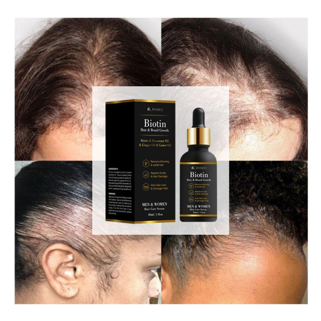 Customizable Hair Growth Essential Oil with Organic Peppermint Ginger Herbal Ingredients Vegan Nourishing and Logo Added