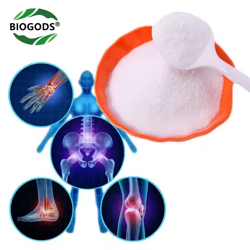 99% N-Acetyl Glucosamine Powder (NAG),Joint and Intestinal Support Supplement N-A-G,CAS 7512-17-6