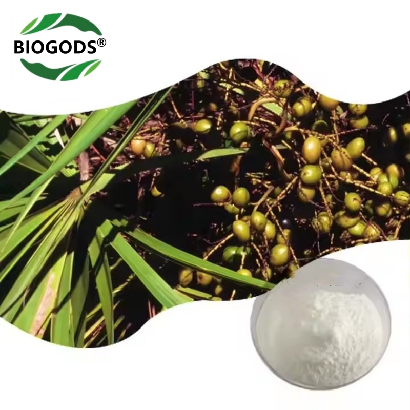 100% Saw Palmetto Extract Powder 20:1,Serenoa Repens Supports Prostate and Urinary Tract Health,Hair Growth Aids,Balances Hormones.DHT Blocker