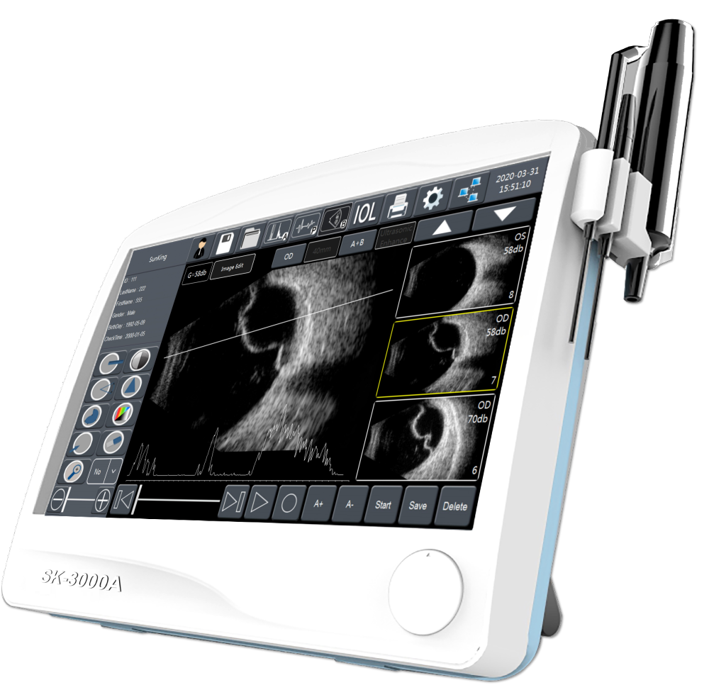 ULTRASOUND  ABP SCAN