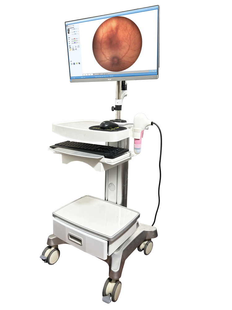 ROP WIDE FIELD RETINA GAMERA