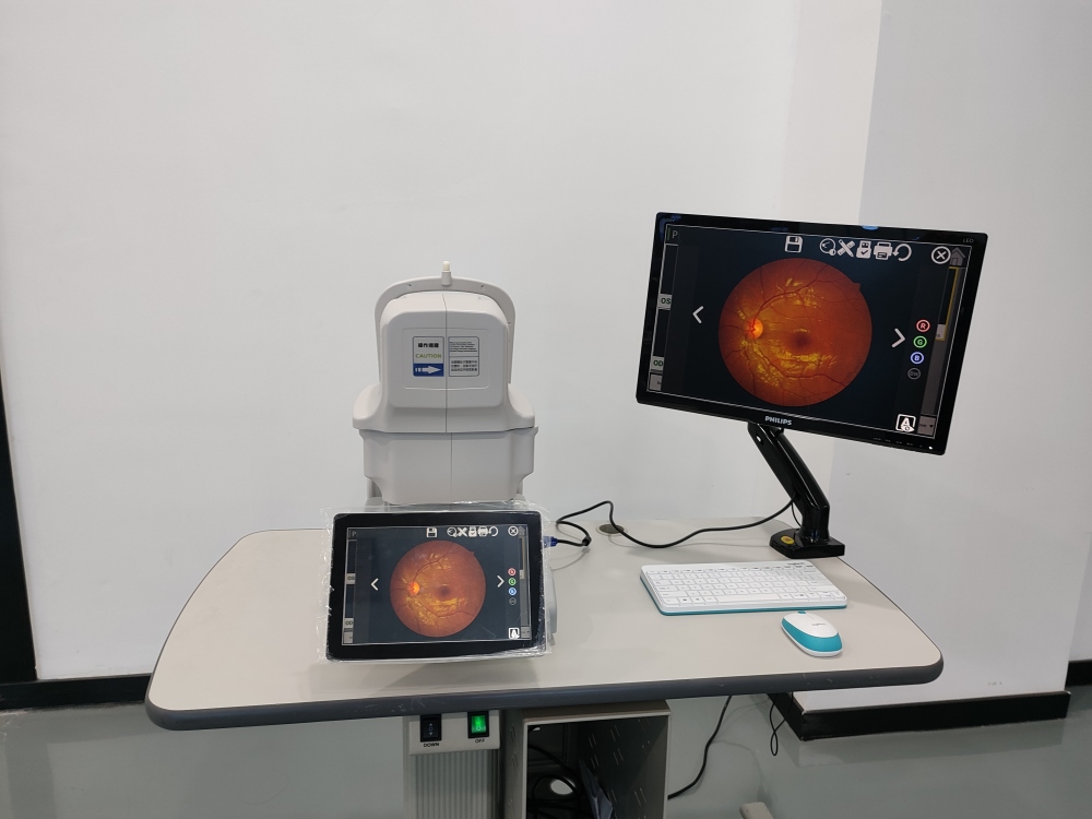 NON-MYDRIATIG AUTOMATIC FUNDUS CAMERA