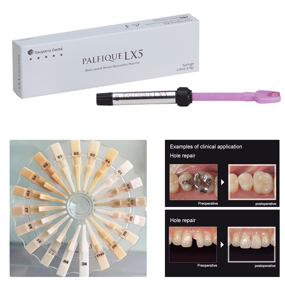 Tokuyama Dental Palfique LX5 Resin Based Restorative Composite 3.8gm All Shades