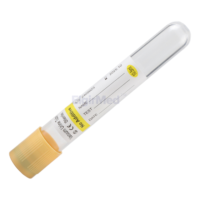 Yellow Top Blood Tube