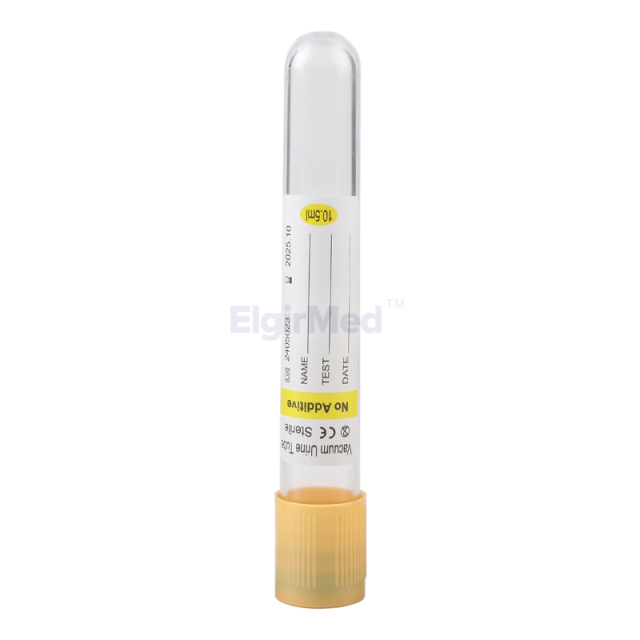 Yellow Top Blood Tube