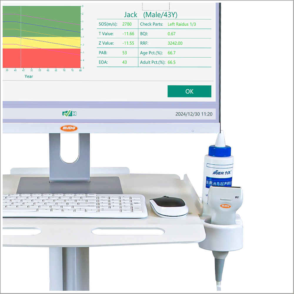 MJD-9000B / Detector de densidade óssea ultrassônico portátil com carrinho