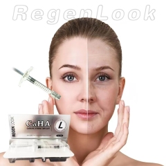 OEM High Quality RegenLook Injectable Collagen Stimulator and Biostimulator PLA/Ha Hybrid Implant Effectively Removes Wrinkles and Tightens Skin/Radiesse Calcium hydroxylapatite gel