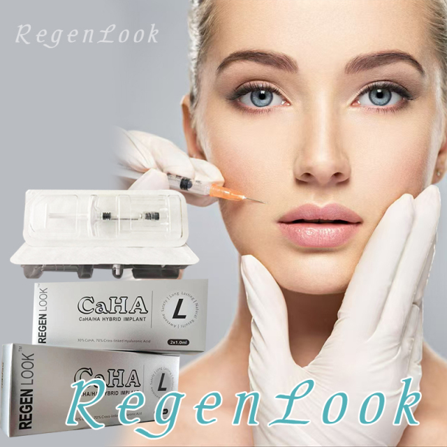 OEM High Quality RegenLook Injectable Collagen Stimulator and Biostimulator PLA/Ha Hybrid Implant Effectively Removes Wrinkles and Tightens Skin/Radiesse Calcium hydroxylapatite gel