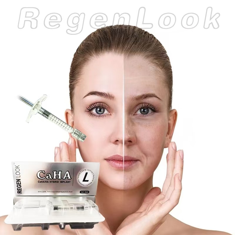 RegenLook 10ml Cross-Linked Hyaluronic Acid Sodium Hyaluronate Skin Filler and Facial Lip Breast Buttock Penis Enlargement Facial Wrinkles Plastic Surgery