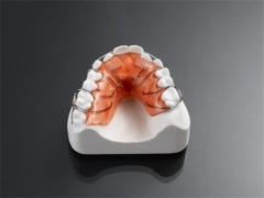 Push Spring Aligners