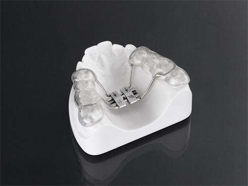 Rapid Palatal Expansion with hooks